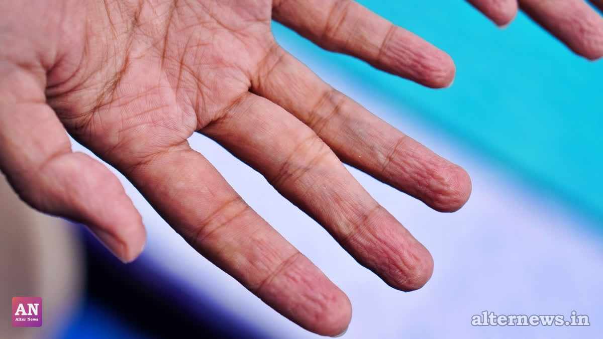 Why Fingers Wrinkle in Water: Science Reveals an Evolutionary Secret Behind Pruney Skin