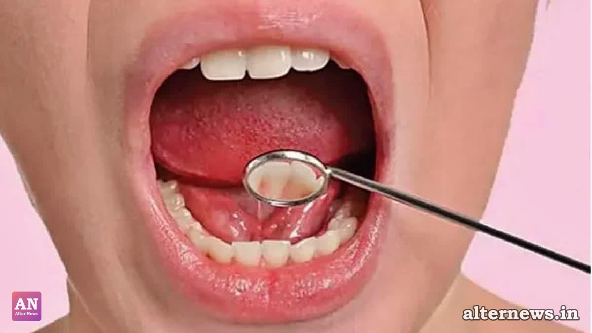 Despite Bans on Gutkha and Khaini, Widespread Tobacco Use Fuels India’s Oral Cancer Crisis